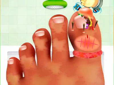 Tırnak Ameliyatı Oyunu oyun ekran görüntüsü
